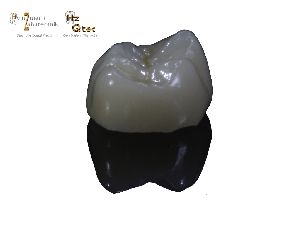 e-max® press, Celtra® press, Cercon®ht Zirkon Monolith, Cercon®ht geschichtet