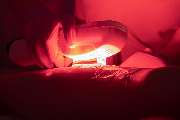 Haarentfernung Erding - Hairless Skin - 42